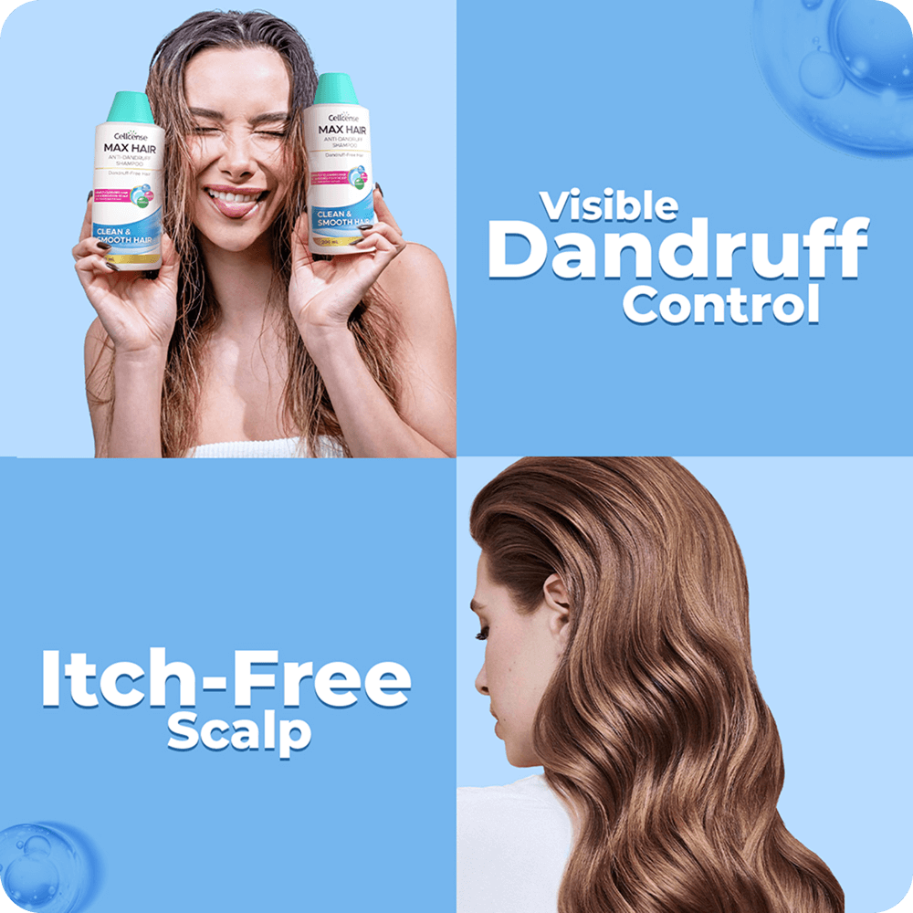 Max Hair Anti-Dandruff