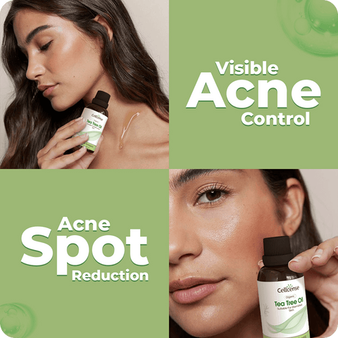 Tea Tree Oil